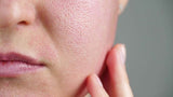 Natural Skincare Routines for Sensitive Skin