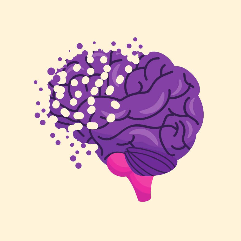 Alzheimer