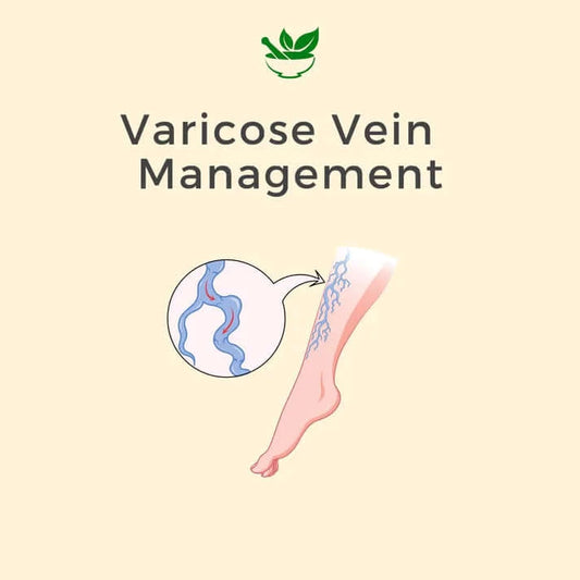 Varicose Vein Ayurvedic Management Ayurvedic Consultation