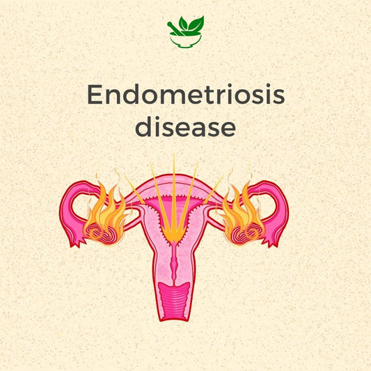 Endometriosis Ayurvedic Management Consultation