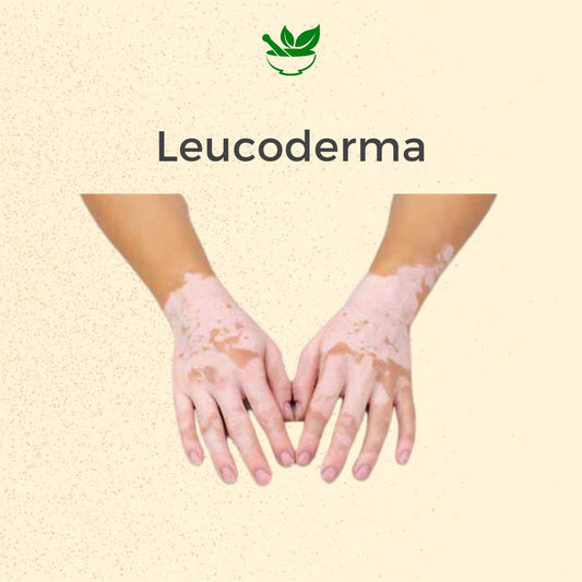 Leucoderma Ayurvedic Management Consultation